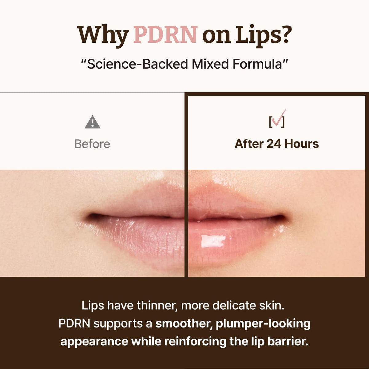 Advanced PDRN Rejuvenating Lip Serum Deep Nourishing Anti-Wrinkle Plumping Treatment | Buy 1 Get 1 Free