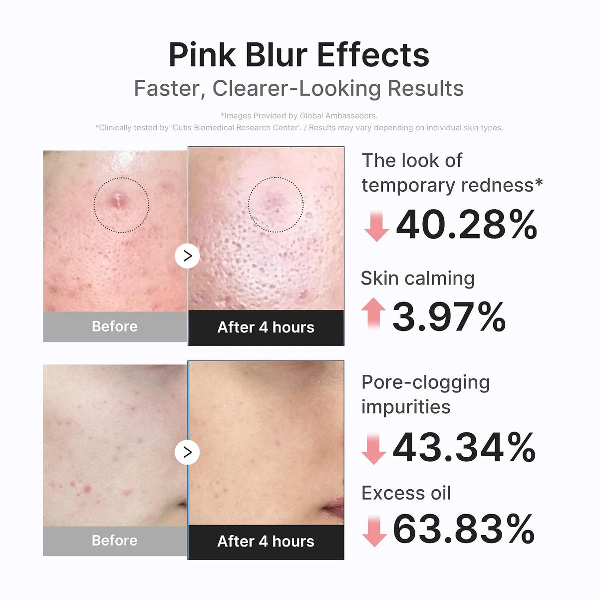 3H Fast Blemish Drying Lotion Targeted Overnight Spot Treatment For Troubled Skin | Buy 1 Get 1 Free