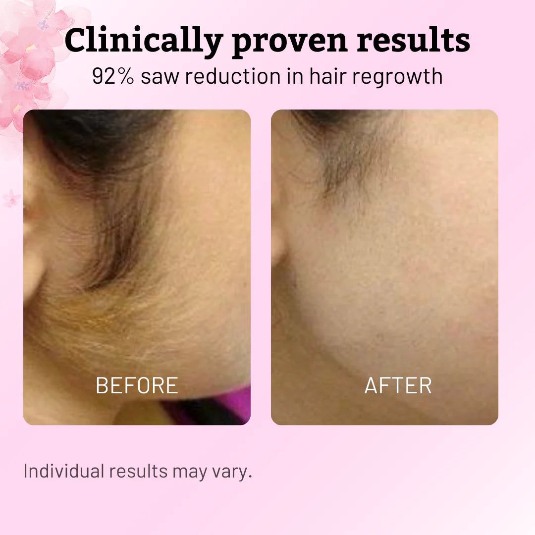 Stop Shaving Daily: Natural Hair Removal Support with Pure Cyperus Rotundus Oil