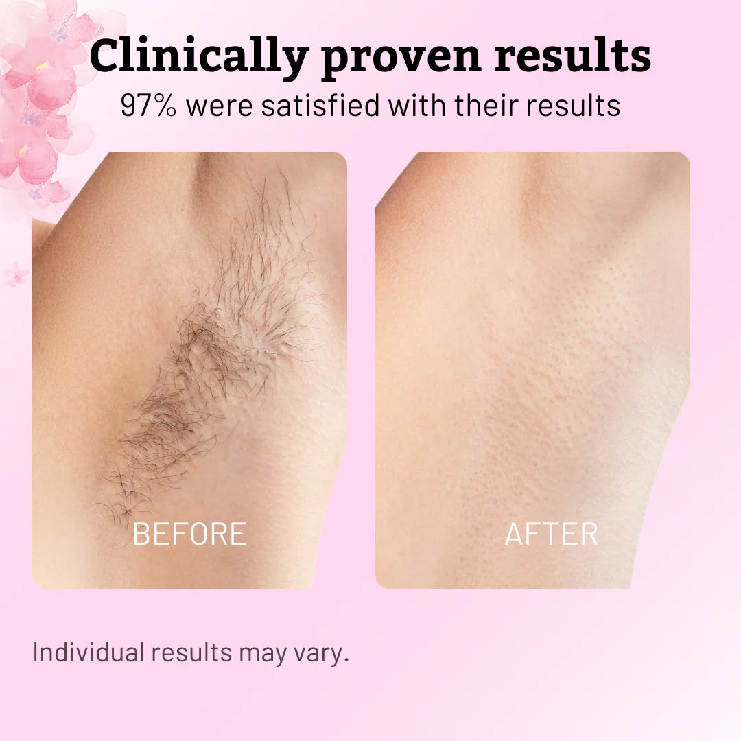 Stop Shaving Daily: Natural Hair Removal Support with Pure Cyperus Rotundus Oil