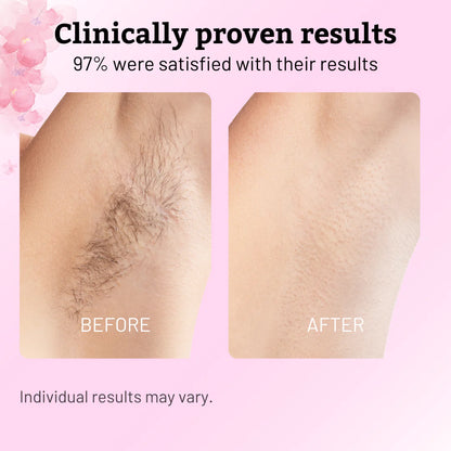 Stop Shaving Daily: Natural Hair Removal Support with Pure Cyperus Rotundus Oil