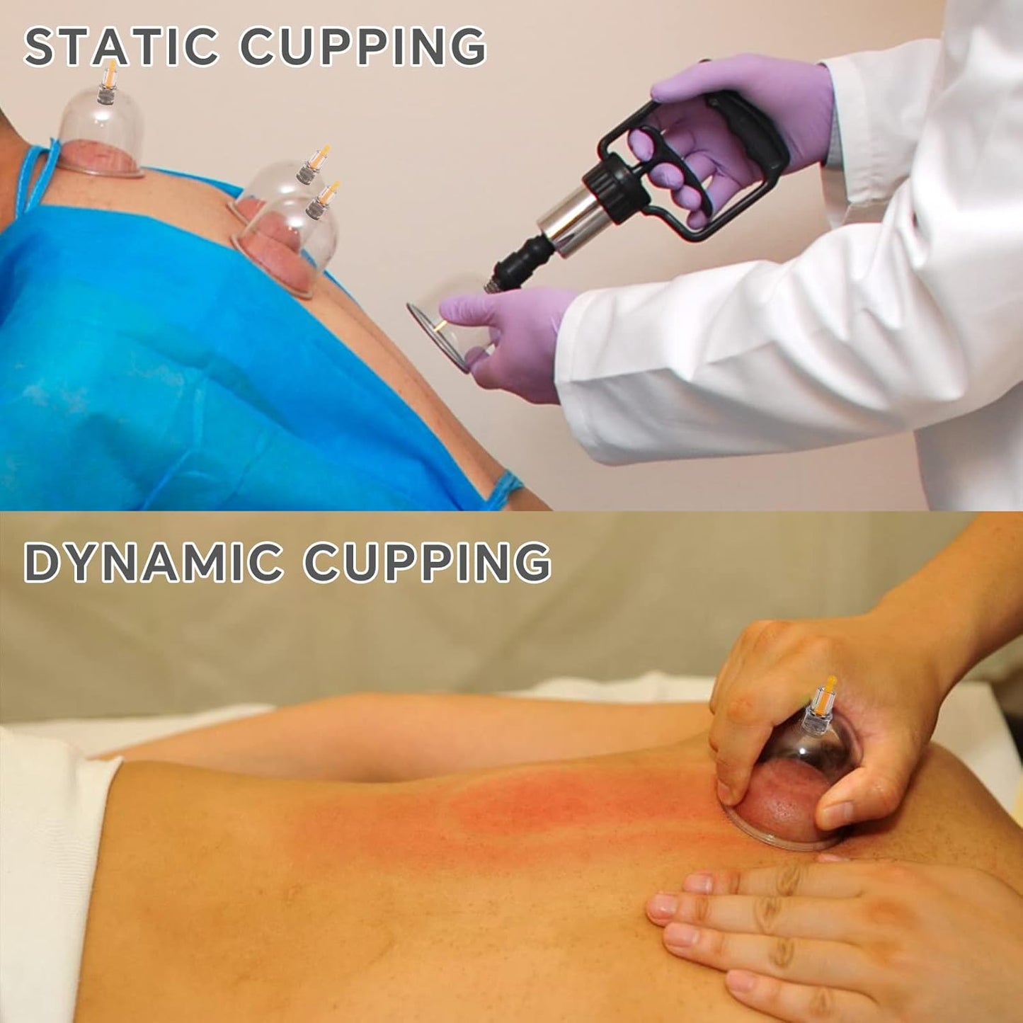 Relieve Muscle Pain and Sculpt Your Body With 12-Level Smart Electric Cupping Massager