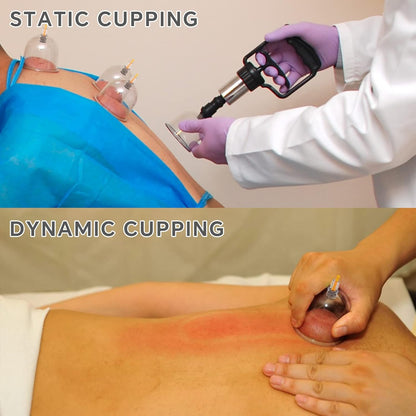 Relieve Muscle Pain and Sculpt Your Body With 12-Level Smart Electric Cupping Massager