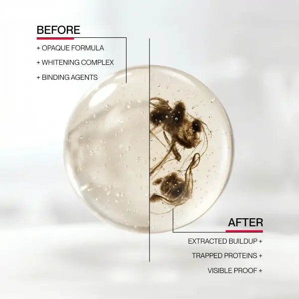 Stain-Conquering & Gunk-Targeting Whitening Mouthwash for Instant Fresh Breath