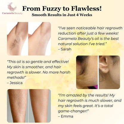 Stop Shaving Daily: Natural Hair Removal Support with Pure Cyperus Rotundus Oil