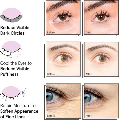 Revitalize Tired Eyes and Erase Dark Circles With Gold Energy