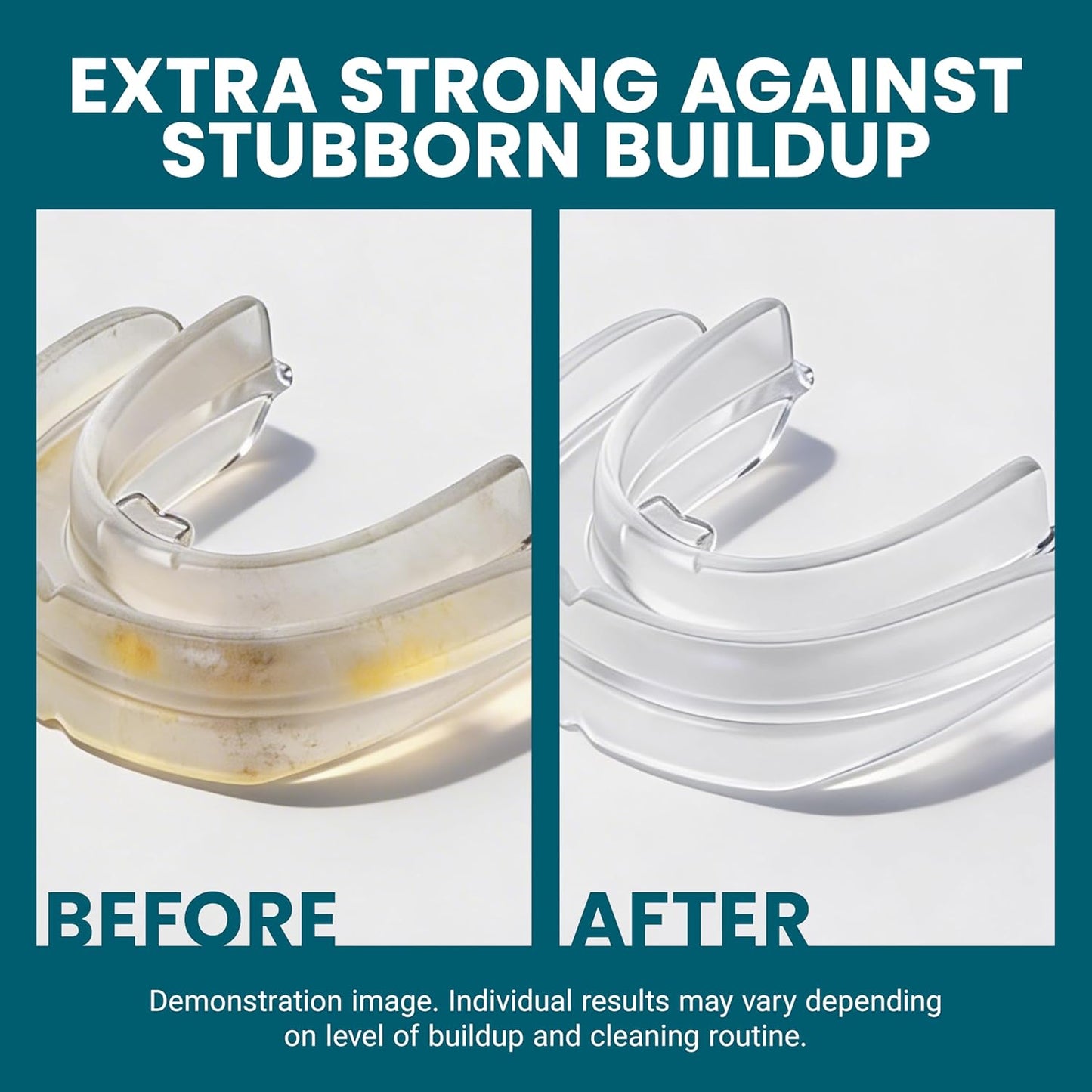 Keep Your Retainers Crystal Clear With Our Advanced 3-In-1 Tablets