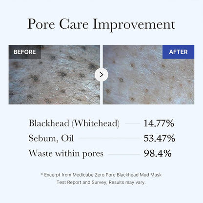 3-Minute Pore Purifying & Blackhead Clearing Mud Mask