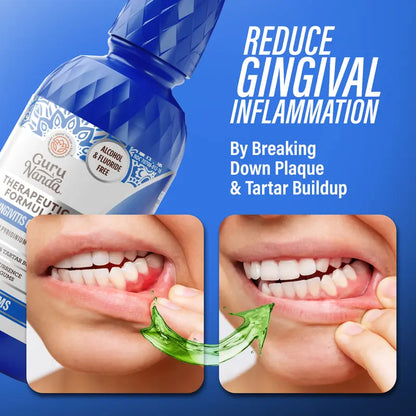 GuruNanda Anti-Gingivitis Oral Rinse | Buy 1 Get 1 Free