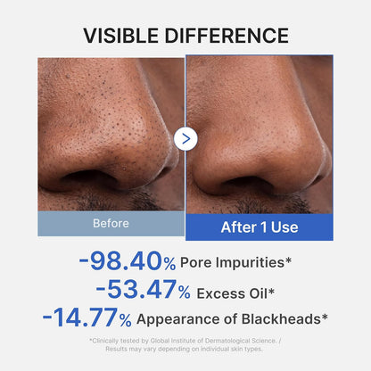 Zero Pore Blackhead Mud Mask AHA BHA PHA Clay Facial Cleanser