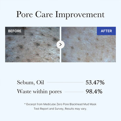 Zero Pore Blackhead Mud Mask AHA BHA PHA Clay Facial Cleanser