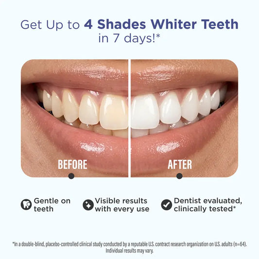 Get Brighter Teeth in 7 Days Without Sensitivity | Buy 1 Get 1 Free