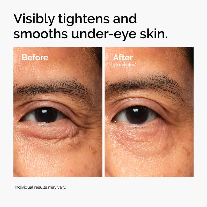 Lacto-PDRN 4% + B9 Eye Cream for Instant Firming & Dark Circle Brightening | Buy 2  Get 1 Free