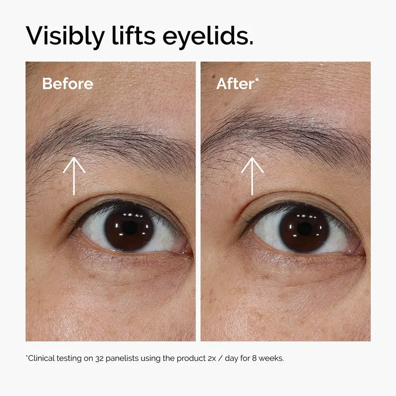Lacto-PDRN 4% + B9 Eye Cream for Instant Firming & Dark Circle Brightening | Buy 2  Get 1 Free