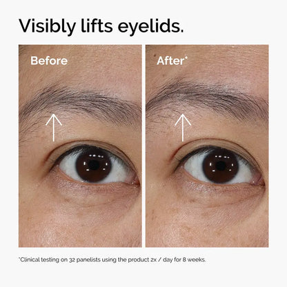 Lacto-PDRN 4% + B9 Eye Cream for Instant Firming & Dark Circle Brightening | Buy 2  Get 1 Free