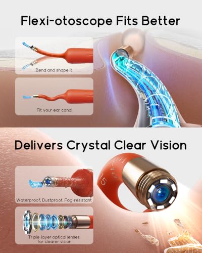 Promotional infographic for a flexible ear camera showing two feature sections: 'Flexi-otoscope Fits Better' with bendable orange probe diagrams, and 'Delivers Crystal Clear Vision' highlighting a gold camera tip with blue lens and triple-layer optics.
