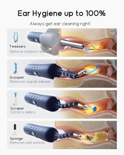 Infographic showing ear wax removal tool with 4 attachment types: Tweezers (removes stubborn earwax), Scooper (regular earwax), Scraper (extracts debris), and Sponge (wet earwax). Each shown inside a cross-section of an ear canal.