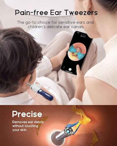 Promotional banner for Bebird pain-free ear tweezers showing an adult using the device on a child's ear while viewing a live ear canal feed on a smartphone. Lower panel shows a close-up of the tweezer tip inside an ear canal with text 'Precise - Removes ear debris without touching your skin.'