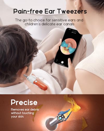 Promotional banner for pain-free ear tweezers showing an adult using an orange ear camera tool on a child while viewing a live ear canal feed on a smartphone. Lower panel shows a close-up of the tweezer tip removing ear debris without touching skin.