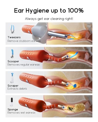 Infographic titled 'Ear Hygiene up to 100%' showing 4 ear canal cross-sections demonstrating attachment tips: Tweezers for stubborn earwax, Scooper for regular earwax, Scraper for debris, and Sponge for wet earwax.