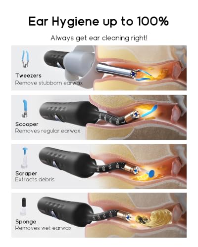 Infographic titled 'Ear Hygiene up to 100%' showing four ear cleaning tool attachments: Tweezers, Scooper, Scraper, and Sponge, each shown alongside a cross-section diagram of an ear canal.