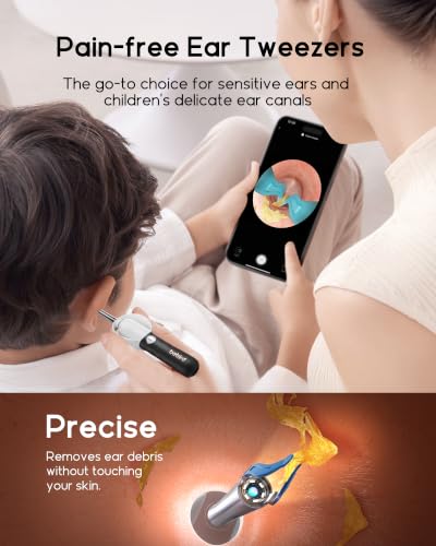 Promotional banner for Bebird pain-free ear tweezers showing an adult using the device on a child while viewing a live ear canal feed on a smartphone. Lower panel shows a close-up of the tweezer tip inside an ear canal with text 'Precise - Removes ear debris without touching your skin.'