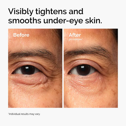 Lacto-PDRN 4% + B9 eye cream 15ml, source product photo 2